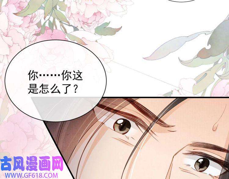 君宠难为第24话 照顾他