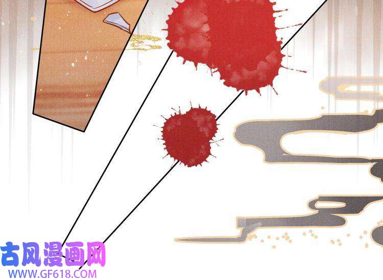 君宠难为第95话 他不认识我了