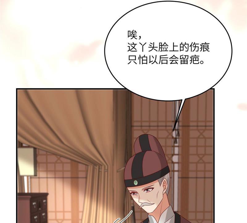 腹黑邪王宠入骨103话 有他在，很安心