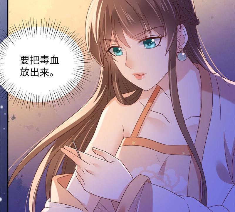 腹黑邪王宠入骨118话 命悬一线