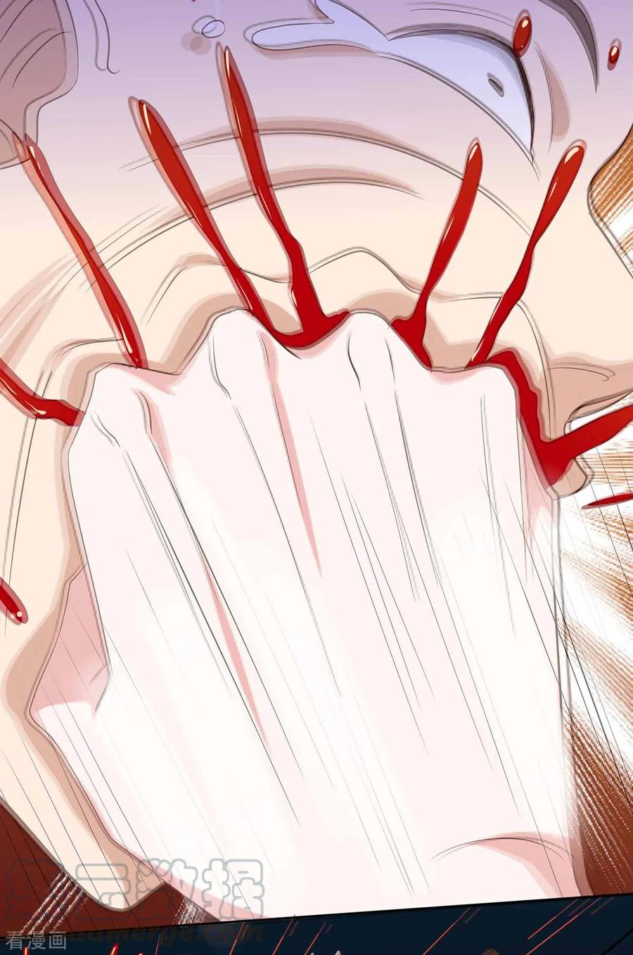 天才狂医113话 寻仇