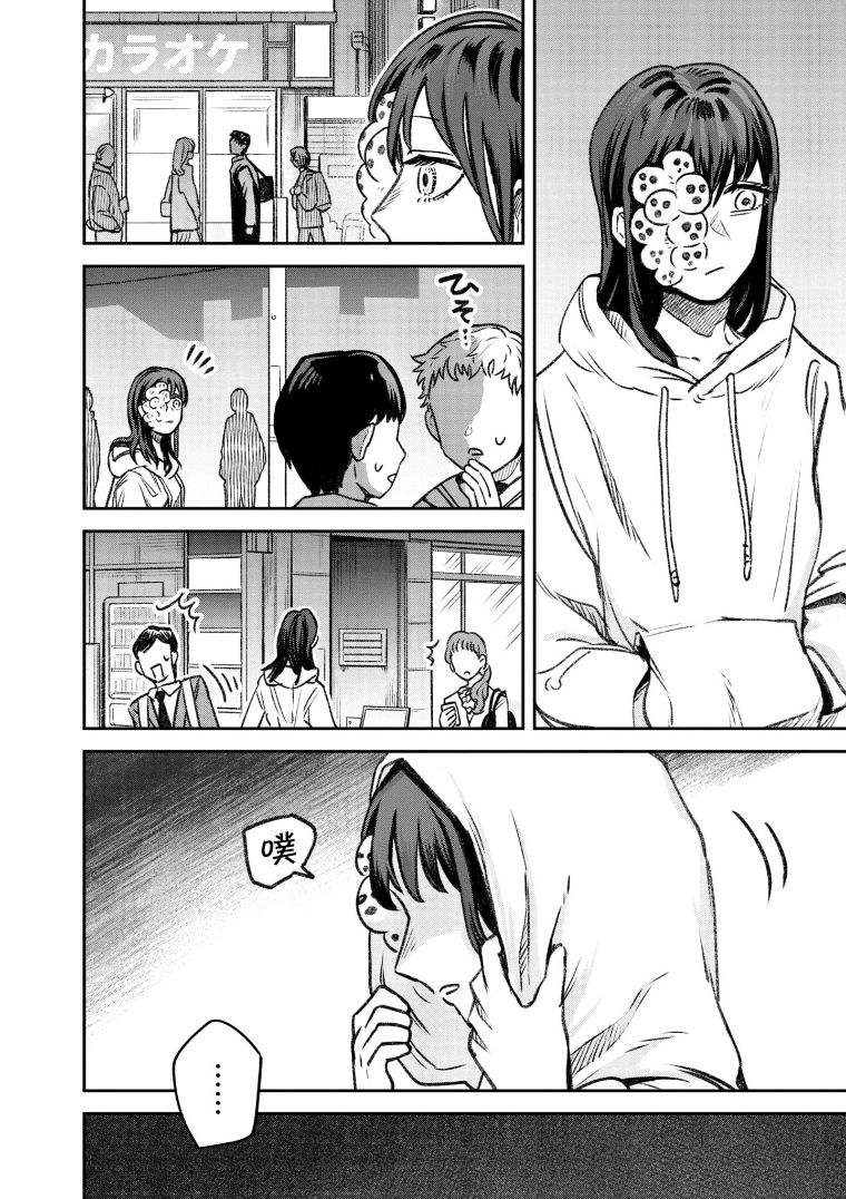 与面疮相伴第48话