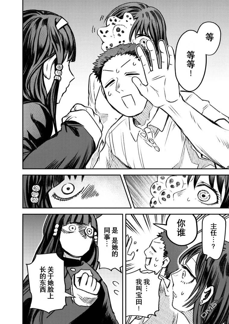 与面疮相伴第49话