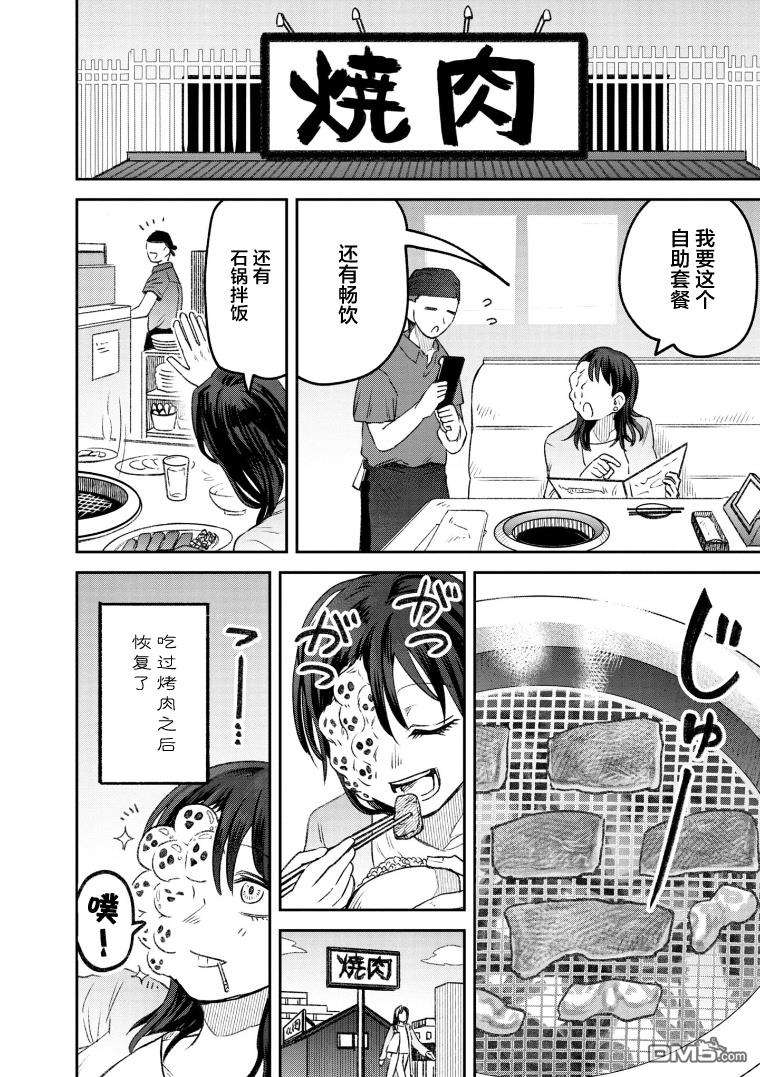 与面疮相伴第55话