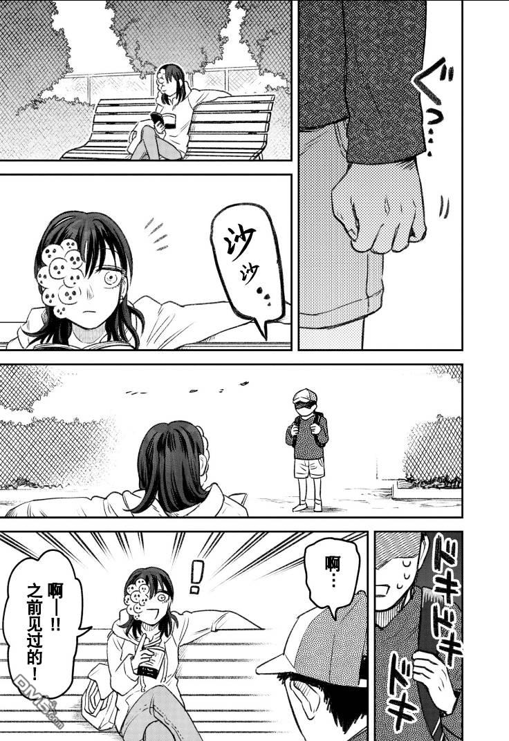 与面疮相伴第57话