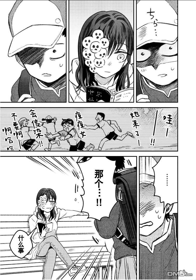 与面疮相伴第57话