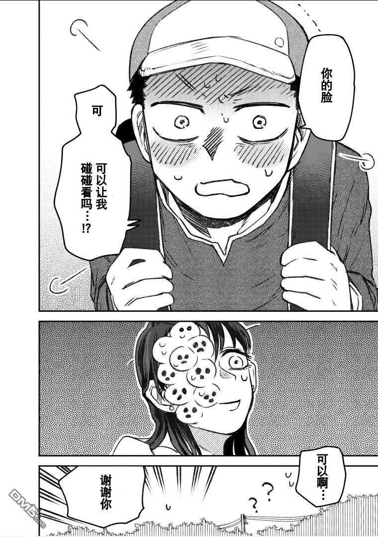 与面疮相伴第57话