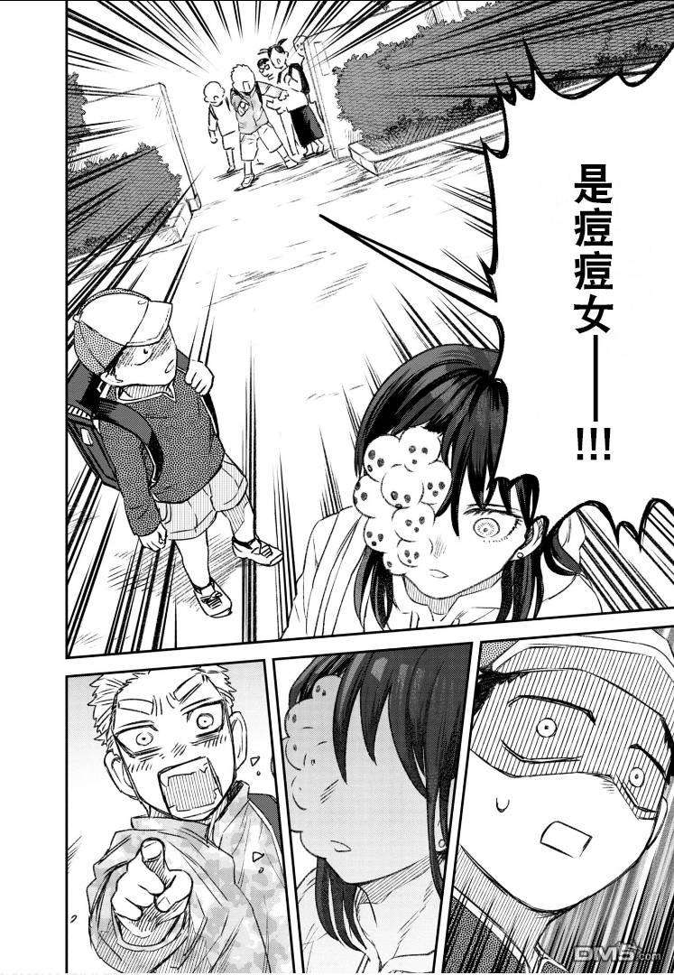 与面疮相伴第58话