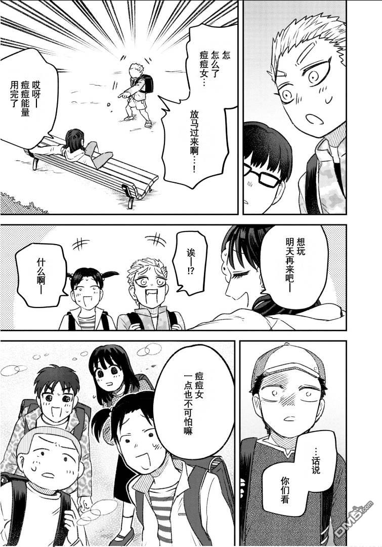 与面疮相伴第58话