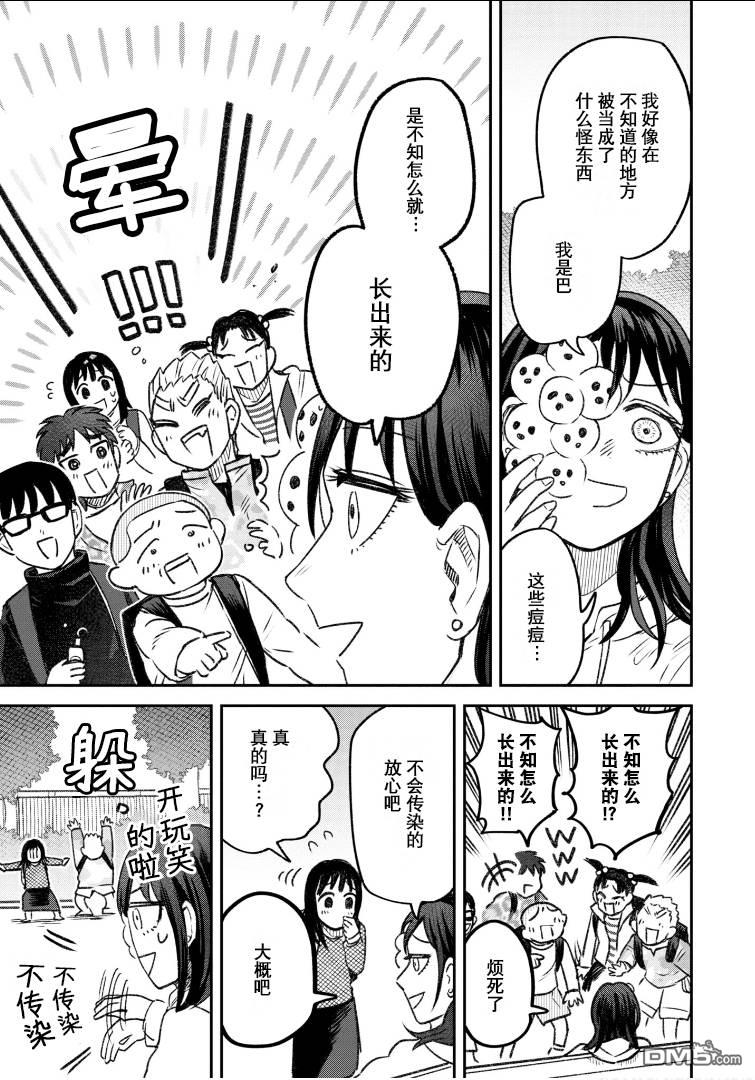 与面疮相伴第58话