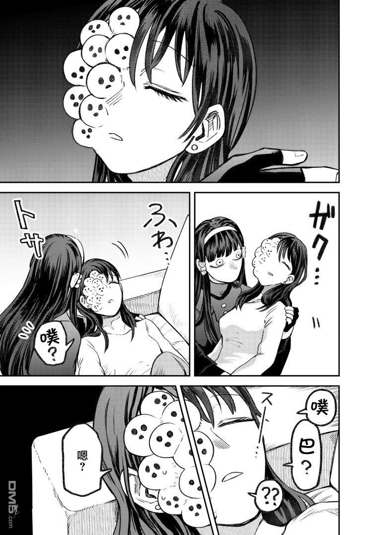 与面疮相伴第68话