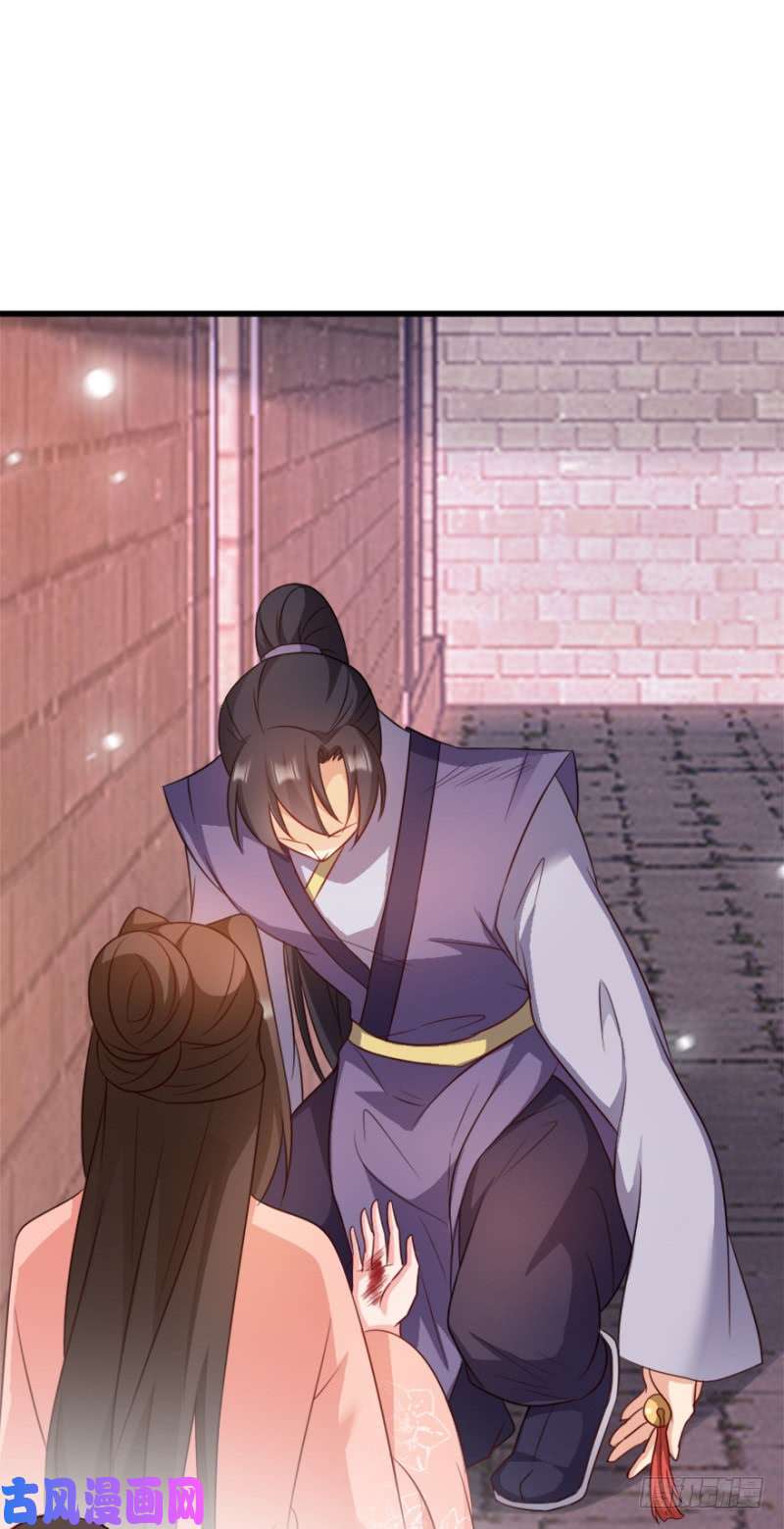 读心狂妃倾天下第72话：中毒