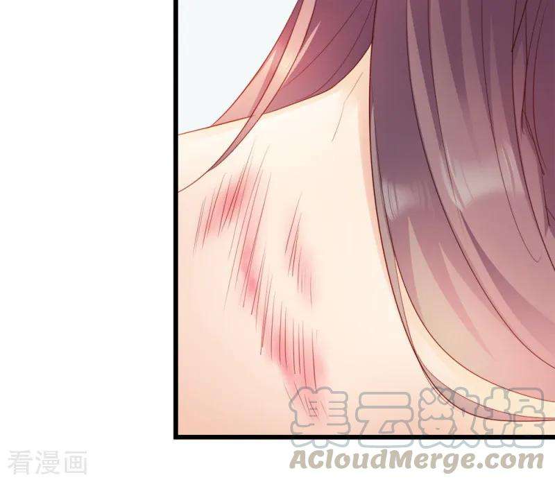 读心狂妃倾天下57话 擦药