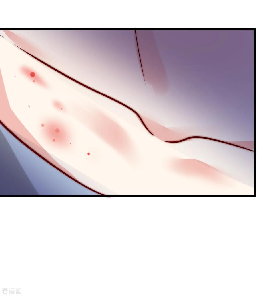 渣男总裁别想逃164话 火火的生日