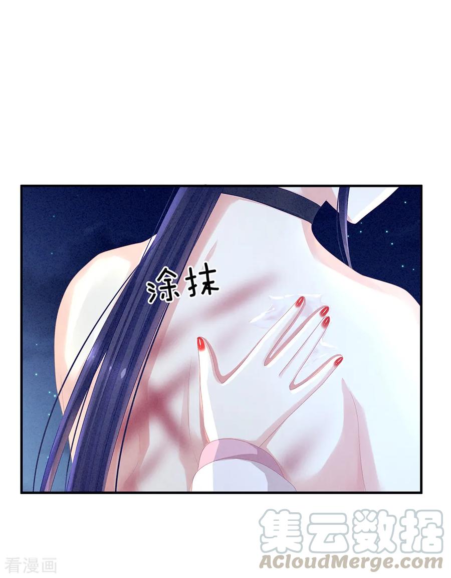 女帝的后宫15话 亲手上药