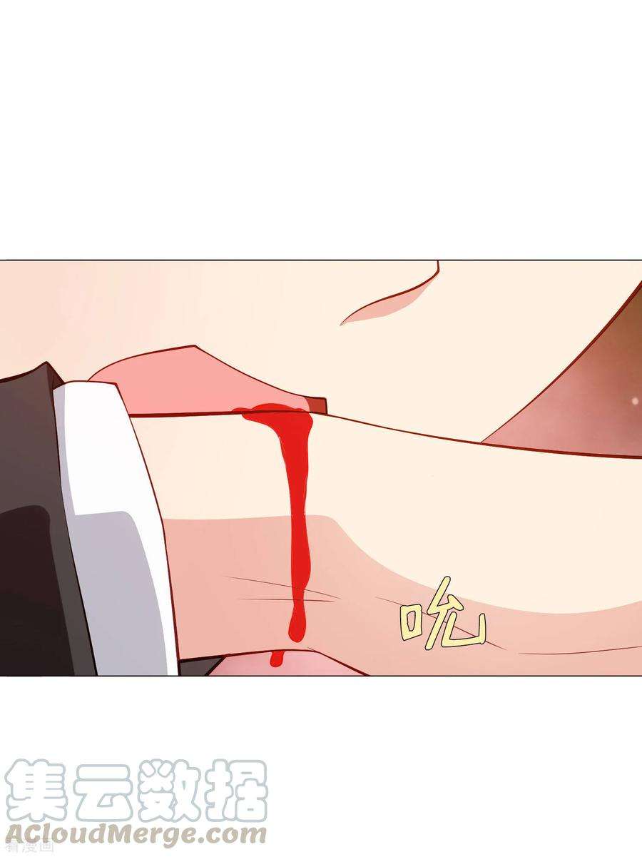 明星是血族148话 落单的未婚妻