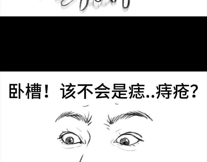 胡渣少女揭秘妙龄少女“痔疮手术”全过程