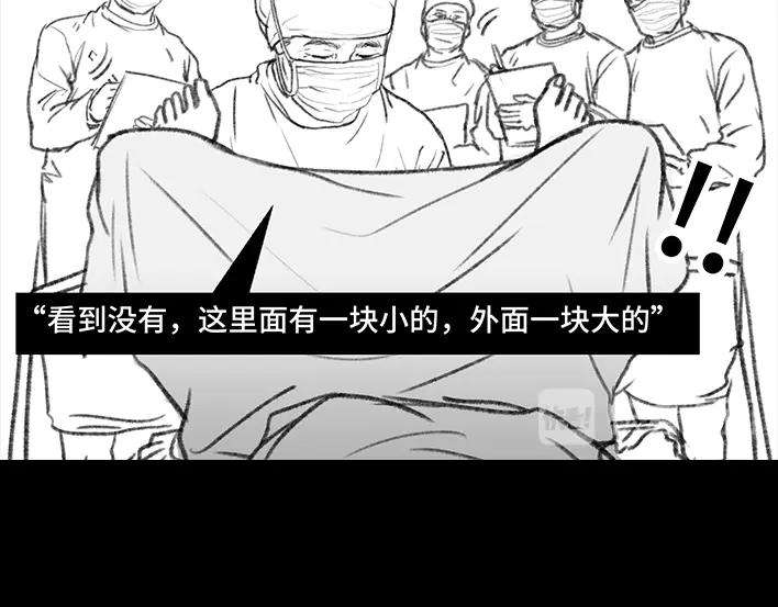 胡渣少女揭秘妙龄少女“痔疮手术”全过程