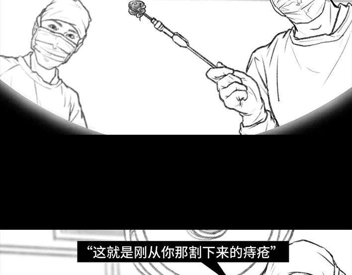 胡渣少女揭秘妙龄少女“痔疮手术”全过程