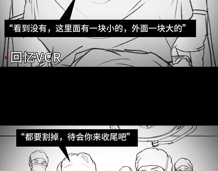胡渣少女揭秘妙龄少女“痔疮手术”全过程
