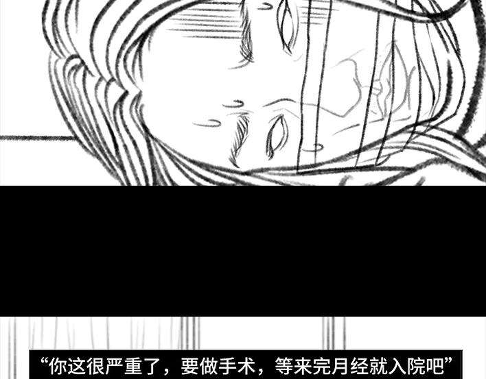 胡渣少女揭秘妙龄少女“痔疮手术”全过程