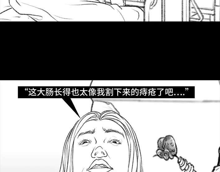 胡渣少女痔疮手术后，我在鬼门关走了80