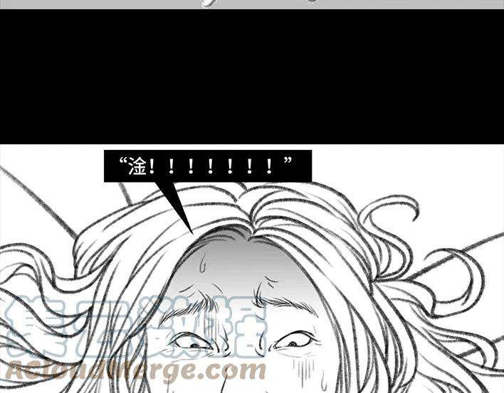 胡渣少女痔疮手术后，我在鬼门关走了80