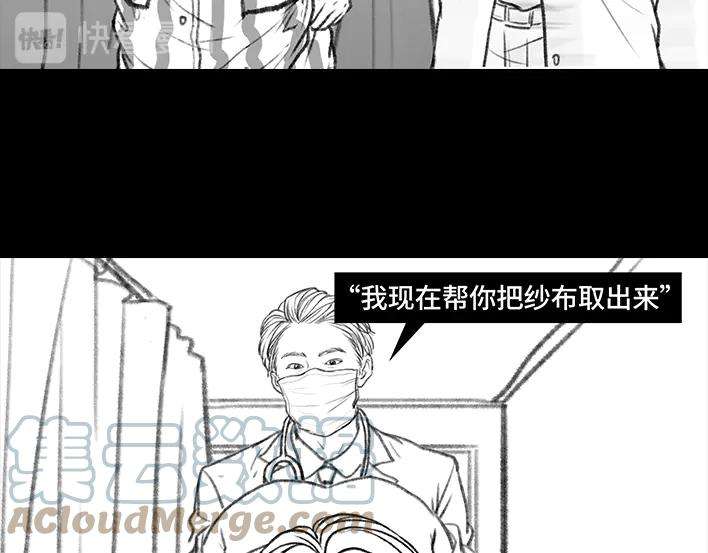胡渣少女痔疮手术后，我在鬼门关走了80