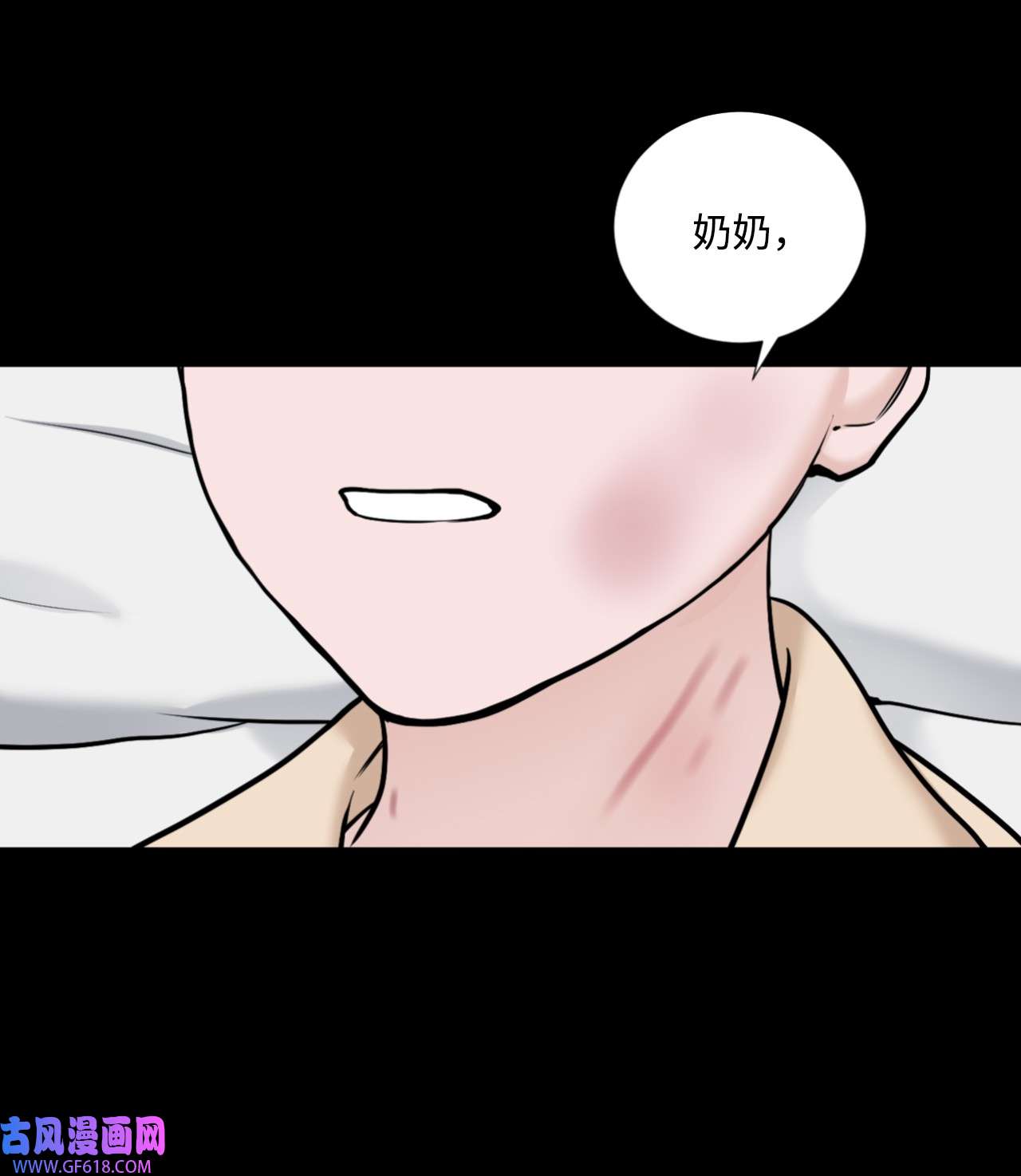 我的秀赫54 受伤