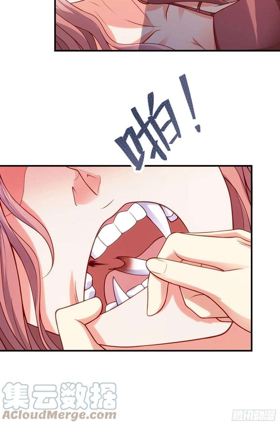 开局吻上裂口女31话 以牙还牙！